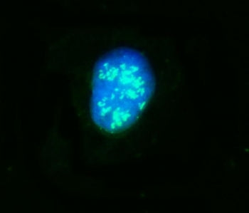 NOP58 Antibody / Nucleolar protein 58