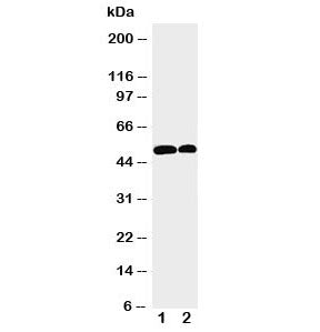 Western blot testing of NOXA1 antibody and Lane 1: U87; 2: HeLa cell lysate. Predicted/observed mole