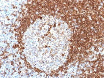 IHC testing of FFPE human tonsil tissue with CD79a antibody (clone HM57). Required HIER: boil tissue