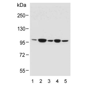 Western blot testing of human 1) RPMI-8226, 2) A549, 3) A431, 4) HT-1080 and 5) MCF7 cell lysate wit