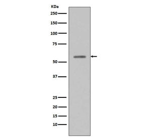 Western blot testing of lysate from human T-47D cells treated with etoposide, with phospho-p53 antib