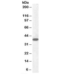 Western blot testing of human cerebellum lysate with Laforin antibody at 0.1ug/ml. Predicted molecul
