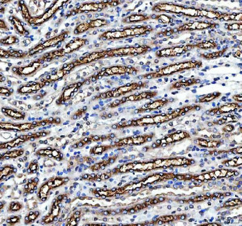 IHC staining of FFPE mouse kidney tissue with NKCC2 antibody, HRP-secondary and DAB substrate. HIER: