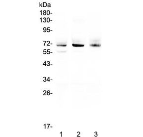 Western blot testing of human 1) A549, 2) SGC-7901 and 3) U-2 OS cell lysate with Bestrophin 1 antib