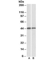 Western blot testing of mouse [A] and rat [B] liver lysate with ACAT1 antibody at 0.1ug/ml. Predicte