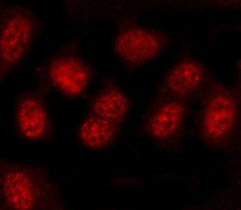 Immunofluorescent staining of FFPE human U-2 OS cells with PRDM4 antibody (red). HIER: steam section