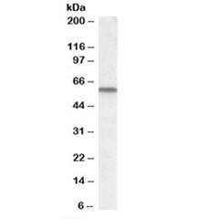 Western blot testing of human lung lysate with VDBP antibody at 1ug/ml. Predicted molecular weight: 