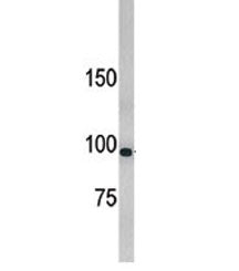 Western blot testing of 293 cell line lysate with LLGL1 antibody. Expected molecular weight: 115-130