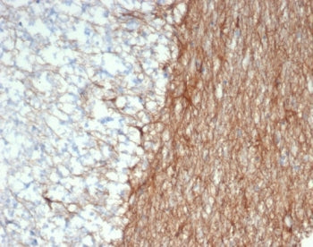 IHC staining of FFPE human brain tissue with GFAP antibody (clone GFAP/6886). HIER: boil tissue sect