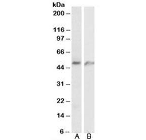 Western blot testing of human A) lung and B) umbical cord lysates with ECSM2 antibody at 1ug/ml. Pre