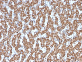 IHC testing of FFPE human liver tissue with Prohibitin antibody (clone PHB/3226). Required HIER: boi