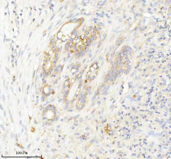 Immunohistochemical staining of INTS4 using anti-INTS4 antibody. INTS4 was detected in a paraffin-em