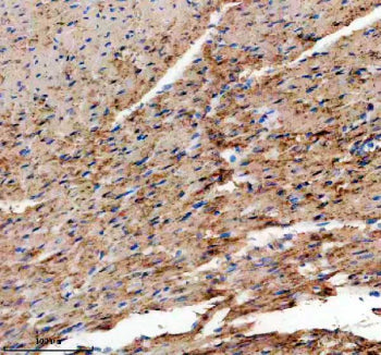 Immunohistochemical staining of TMOD1 using anti-TMOD1 antibody. TMOD1 was detected in a paraffin-em