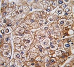 BMPR2 Antibody