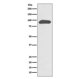 Western blot testing of human SH-SY5Y cell lysate with Chromogranin A antibody. Expected molecular w