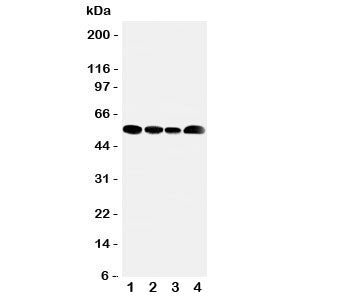Western blot testing of MCT5 antibody and lysate from 1: rat testis; 2: human Jurkat; 3: (h) HeLa; 4