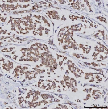 PLXDC2 Antibody / Plexin domain-containing protein 2 / TEM7R