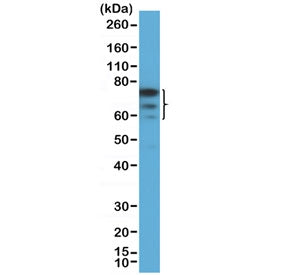 Western blot testing of human HEK293 cell lysate with recombinant FOXP1 antibody at 1:1000 dilution.
