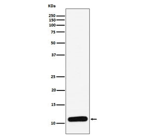 Western blot testing of human spleen lysate with PF4 antibody. Expected molecular weight: ~8/16/32 k