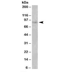 SETDB2 Antibody
