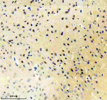 GRM1 Antibody / Metabotropic glutamate receptor 1 / mGluR1, 100ul