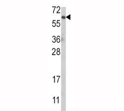 AKT1 Antibody