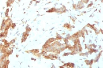 GRP94 Antibody / HSP90B1