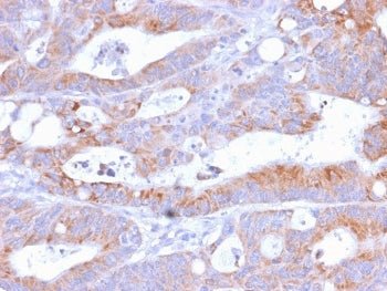 IHC testing of FFPE human colon with recombinant CD86 antibody (C86/2160R). Required HIER: boil tiss