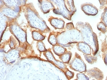 IHC: Formalin-fixed, paraffin-embedded human placenta stained with hCG beta antibody (HCGb/54 + HCGb