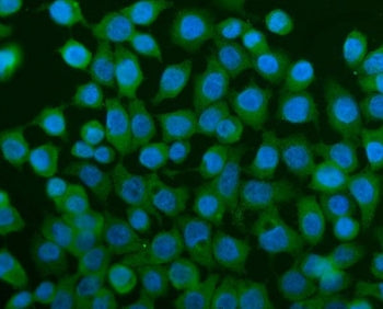 TCP1 alpha Antibody / CCT1