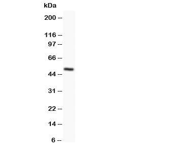 Western blot testing of Orai1 antibody and SKOV lysate; Predicted molecular weight ~ 33 kDa; Observe