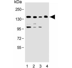 Western blot testing of human 1) K562, 2) Raji, 3) HeLa and 4) NIH 3T3 lysate with UBE4B antibody. P