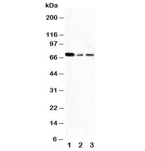 Western blot testing of XRCC1 antibody and Lane 1: 293T; 2: A431; 3: HeLa cell lysate. Rountinely ob