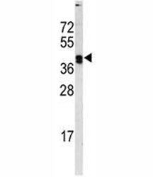 LOX Antibody
