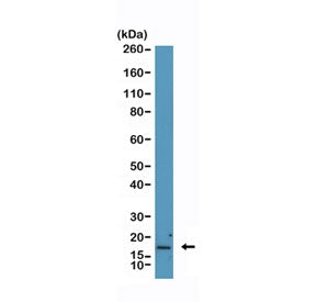 Western blot testing of human HEK293 cell lysate with recombinant p16INK4a antibody at 1:2000. Predi
