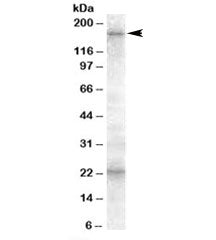 Western blot testing of human cerebellum lysate with ABCC8 antibody at 0.5ug/ml. The expected ~170 k