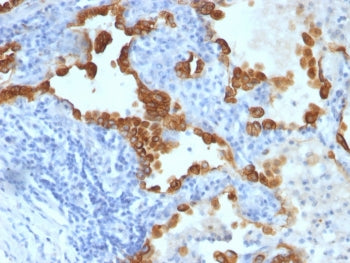 Cytokeratin 8/18 Antibody Cocktail