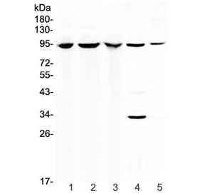 Western blot testing of 1) human 293T, 2) human HepG2, 3) human A549, 4) rat liver and 5) mouse smal