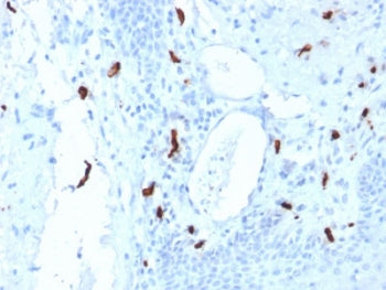 IHC testing of FFPE human tonsil tissue with TPSAB1 antibody (clone TPSAB1/1961). HIER: boil tissue 