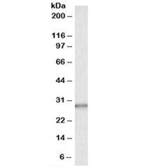 Western blot testing of human liver lysate with CA1 antibody at 0.03ug/ml. Predicted/observed molecu