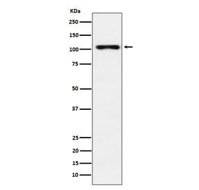 Western blot testing of human thyroid lysate with Thyroid Peroxidase antibody. Predicted molecular w