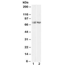 Western blot testing of 1) human HeLa and 2) mouse NIH3T3 lysate with LIMK2 antibody at 1ug/ml. Pred