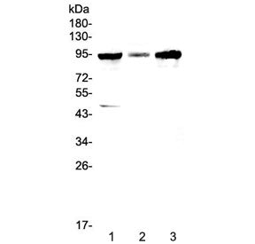 Western blot testing of human 1) HepG2, 2) PANC-1 and 3) SGC-7901 cell lysate with GNS antibody at 0
