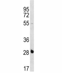 RBPMS Antibody