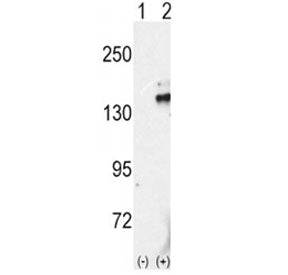 Western blot analysis of RET antibody and 293 cell lysate either nontransfected (Lane 1) or transien