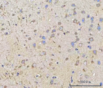 IHC staining of FFPE mouse brain tissue with PPWD1 antibody. HIER: boil tissue sections in pH8 EDTA 