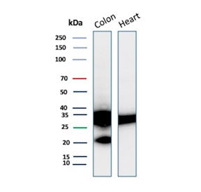 Western blot testing of human colon and heart tissue lysate with recombinant Galectin 3 antibody (cl