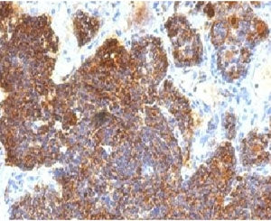 Parathyroid Hormone Antibody / C Terminal
