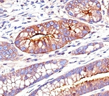 CEA Antibody / Carcinoembryonic Antigen