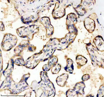 IHC staining of FFPE human placental tissue with CD39 antibody, HRP-secondary and DAB substrate. HIE